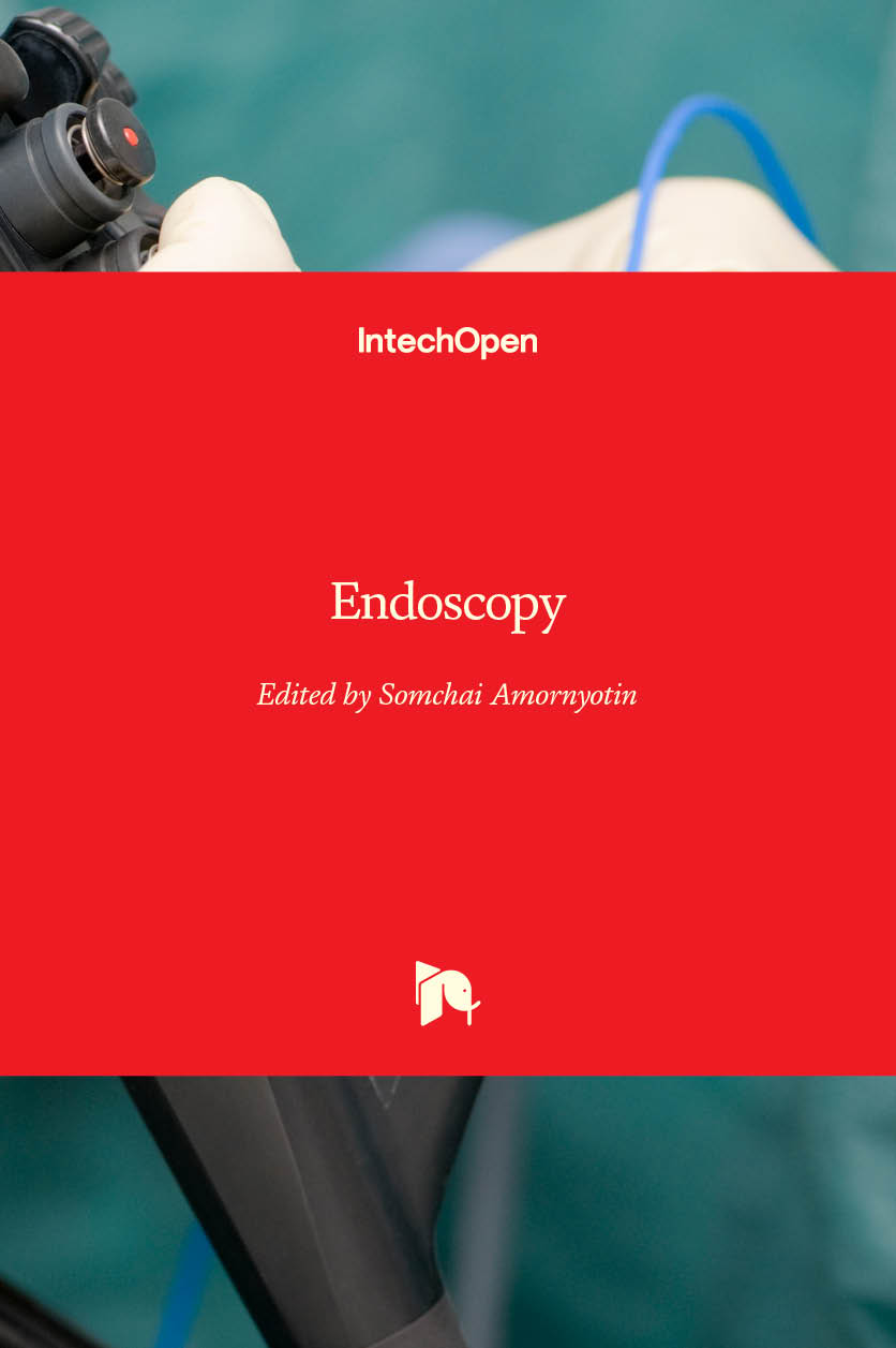 Endoscopy IntechOpen