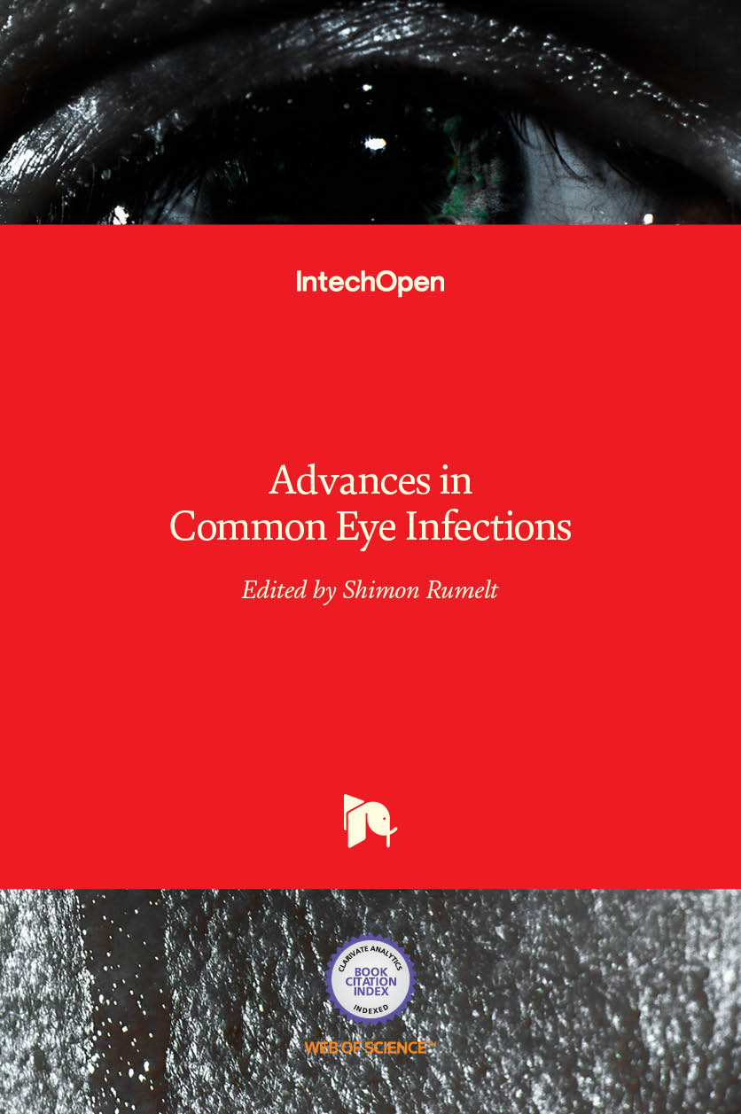 Advances In Common Eye Infections Intechopen 