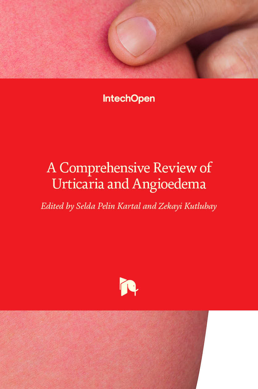 a-comprehensive-review-of-urticaria-and-angioedema-intechopen