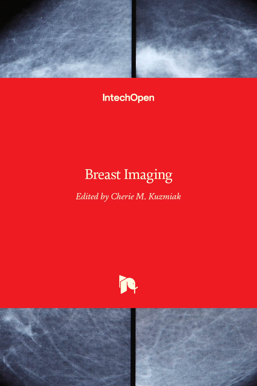 Breast Imaging IntechOpen