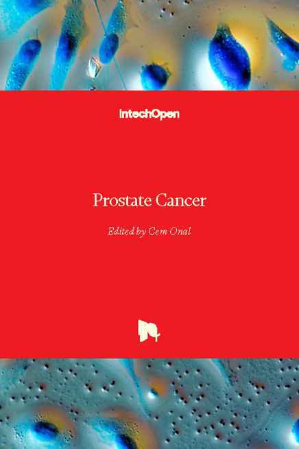 Prostate Cancer Intechopen