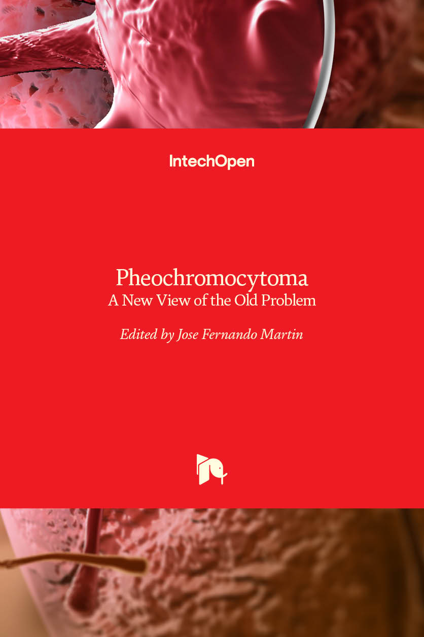 pheochromocytoma-a-new-view-of-the-old-problem-intechopen