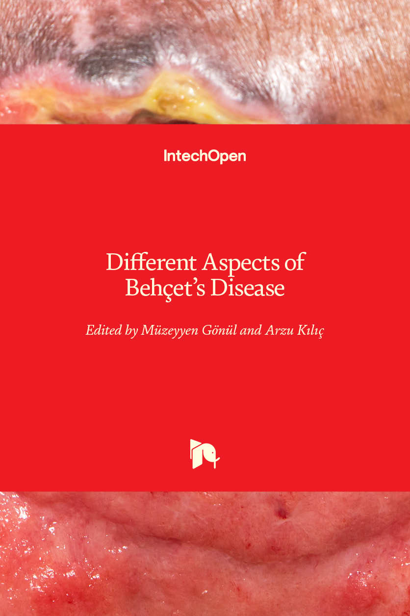Different Aspects Of Behçets Disease Intechopen 2045