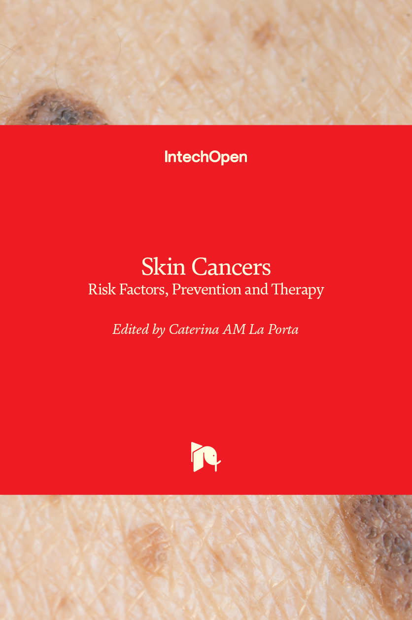 Skin Cancers Risk Factors Prevention And Therapy Intechopen 